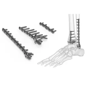 1747122085_Orthopedic Equipment.webp